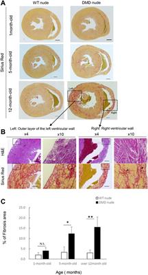 A new immunodeficient Duchenne muscular dystrophy rat model to evaluate engraftment after human cell transplantation